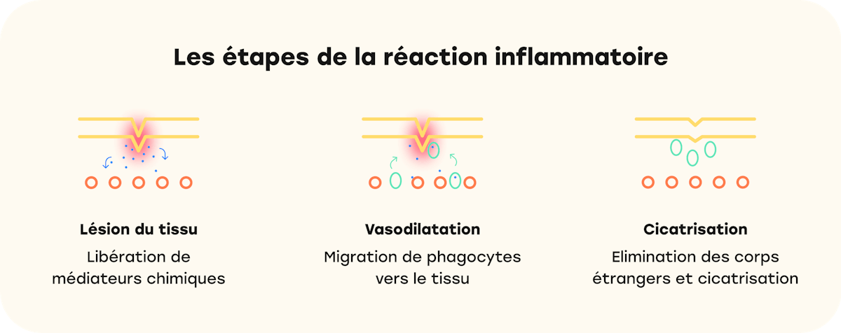 Les antiinflammatoires, ça marche comment